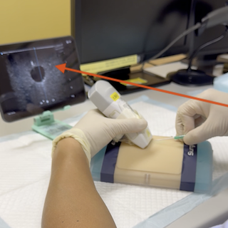 Align the screen and the patient in a single line of sight