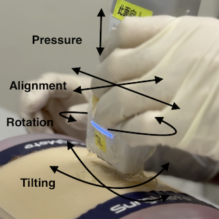 Using the four key manipulation techqnieu with your POCUS probe