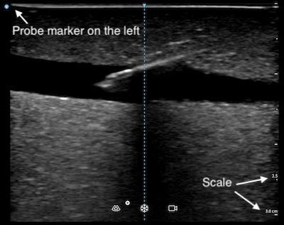 Image marker and scale