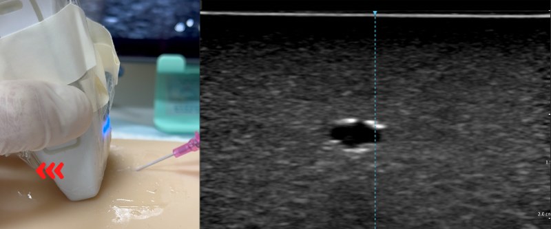 Stop the needle and slide the probe away