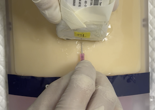 Puncture the skin at the midline marker 